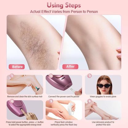 Playexen IPL Hair Removal Device – At-Home Hair Reduction for Face & Body